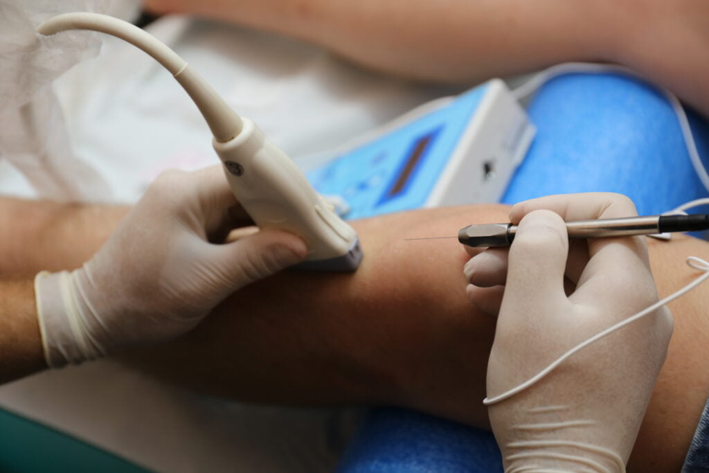 fizjoterapeuta wykonujący zabieg elektrolizy