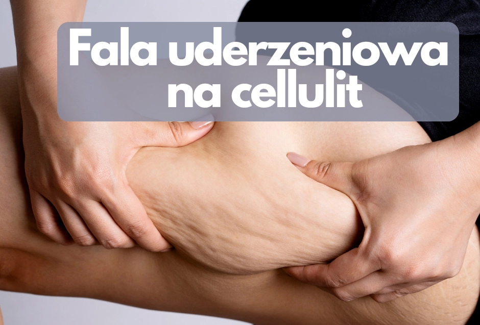 Fala uderzeniowa na cellulit