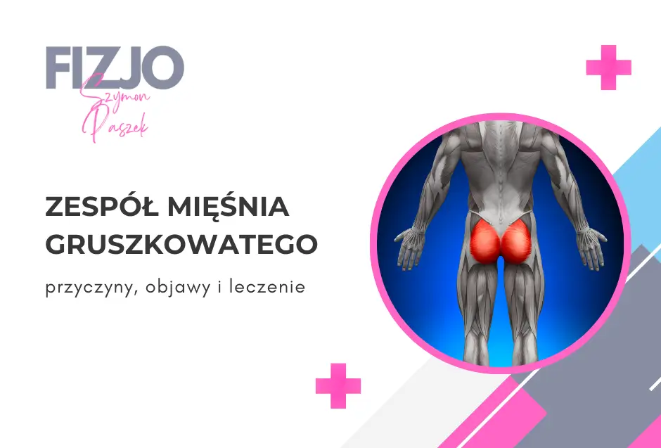 Zespół mięśnia gruszkowatego